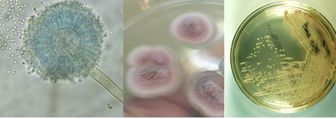 Mecanismos de resistencia en hongos de importancia clínica